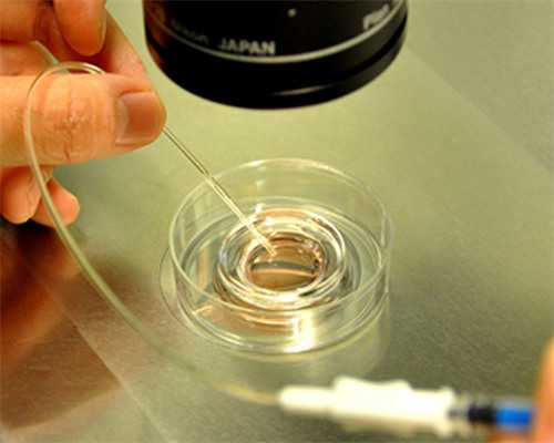 北京代生中介,北京试管包男孩