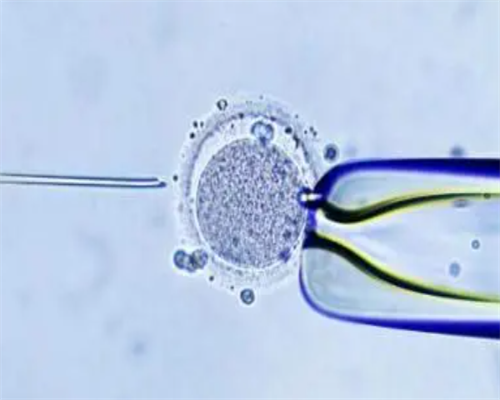 乌克兰自卵[天使博芽国际医疗广州],青海试管婴儿医院如何选择需要注意哪些方