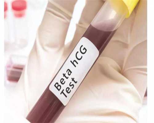 是代孕的吗[精因宝贝助孕咋样],香港供，借卵试管婴儿流程是怎样的香港试管婴