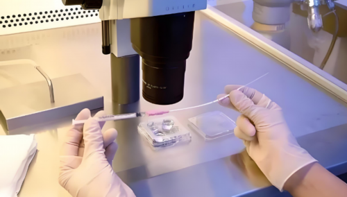 北京大学深圳医院做试管婴儿建档要提前预约和交押金吗?