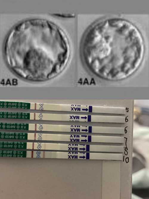 北京试管代孕医院网址,北京试管公司,北京试管婴儿流程