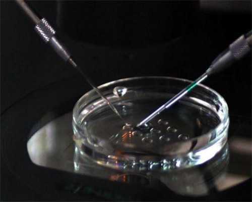 白带突然增多是不是怀孕了？白带突然增多是快来大姨妈了吗？,试管代怀机构