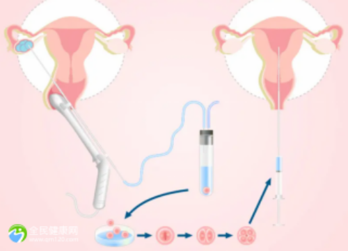 北京供卵代孕包成功,北京白血病研治中心