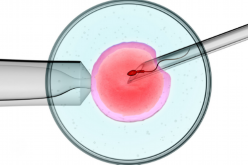 北京借卵自怀条件,北京白血病科医院挂号