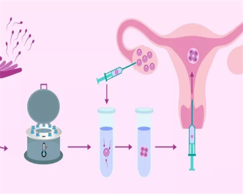 北京朝阳医院做试管费用多少，附过程简单说明！