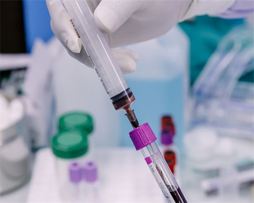 北京不孕不育医院:弱精是怎么回事?如何治疗?,借卵代孕服务