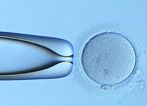 北京合法代生机构,2026北京妇产医院试管婴儿费用明细，北京妇产医院生殖医学