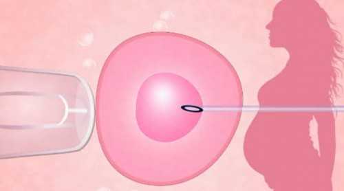 北京代生大概费用,北京试管中介