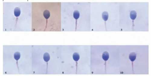 北京代怀中心微信,「难以割舍」北京试管价格