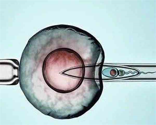 北京哪里代生孩子,北京做试管价格,北京做试管多少钱