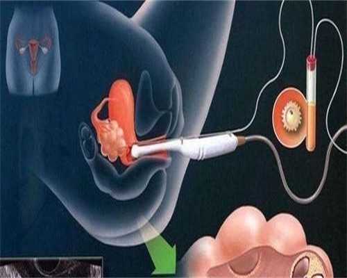 女性身体肥胖对怀孕会不会有一定的影响？太胖是不是容易怀不上？