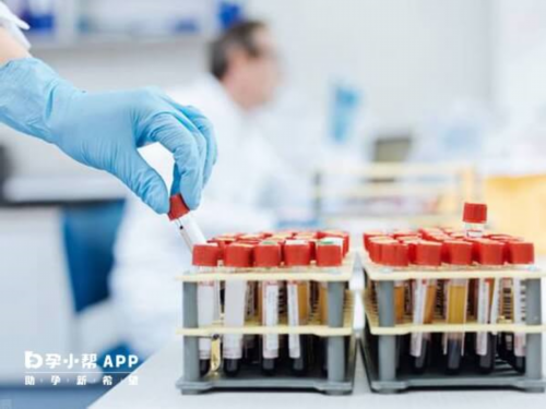 羊水穿刺不正常报告单,供卵试管婴儿