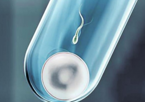 做试管婴儿的详细流程和检查，从检查到成功的全过程,供卵费用明细