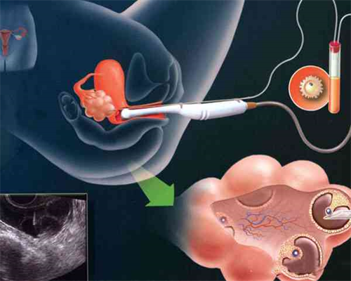 北京代怀价格多少,北京供卵试管婴儿助孕机构,北京供卵试管机构