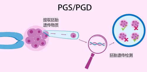 北京海外试管机构预算(海外试管婴儿中介机构)
