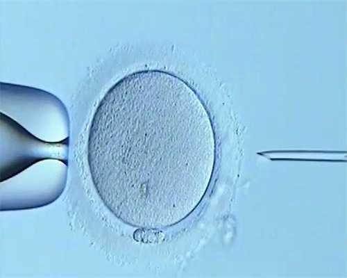 北京代怀孕网,北京试管机构