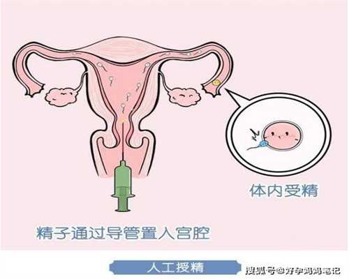 广州有偿捐卵_专家：代孕不利婴儿成长 亟需立法