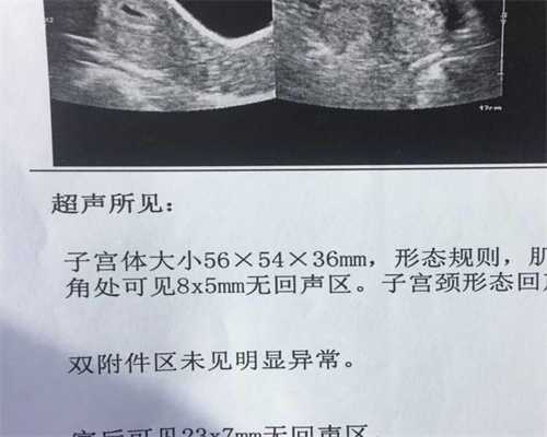 华大国际集团_中国传承国际助孕费用_左侧输卵管