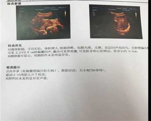 北京代孕时间_代怀服务公司_孕妇吃纸是缺什么东