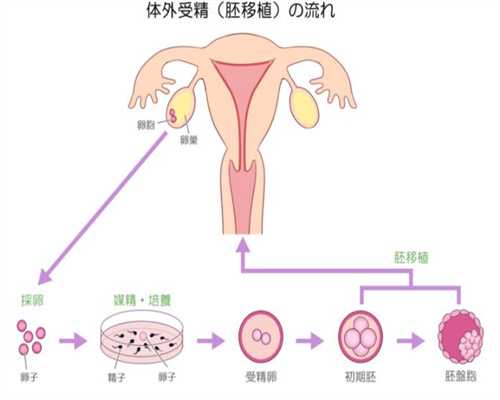 北京65万包成功代孕协议_北京代孕怎样_北京代孕需要什么体俭