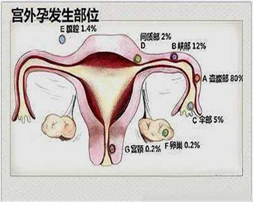 北京有人要找代孕吗_北京最大的中介代孕_北京有有钱人找人代孕的吗